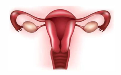 What You Need to Know About Dysfunctional Uterine Bleeding!