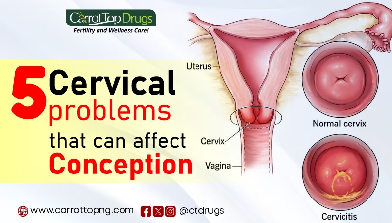 5-cervical-problems-that-can-affect-conception