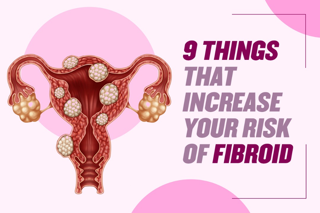 9 things that can increase your risk of fibroids