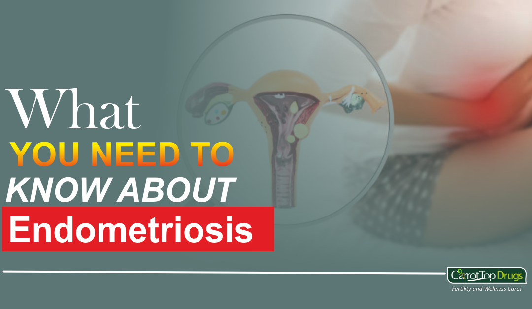 What You Need To Know About Endometriosis