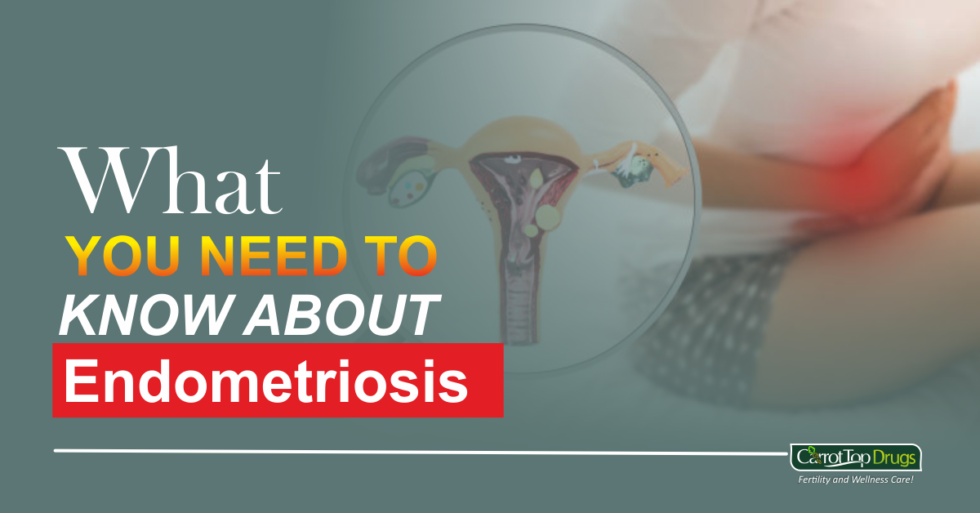 What You Need To Know About Endometriosis - Carrot Top Drug