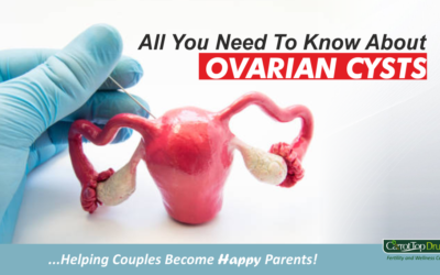 All You Need To Know About Ovarian Cysts