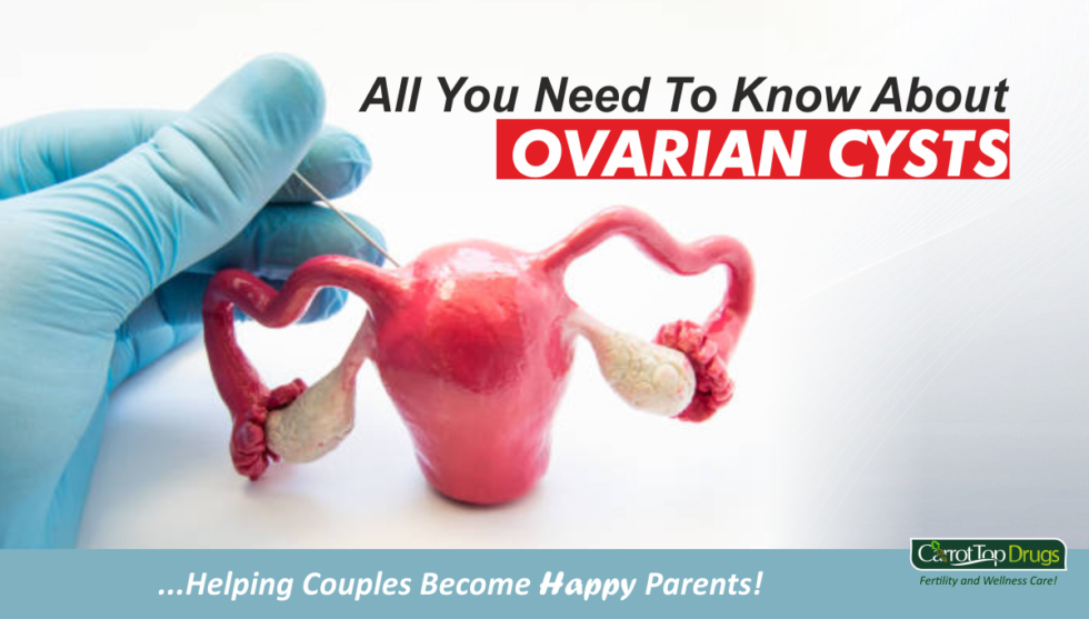 All You Need To Know About Ovarian Cysts - Carrot Top Drug