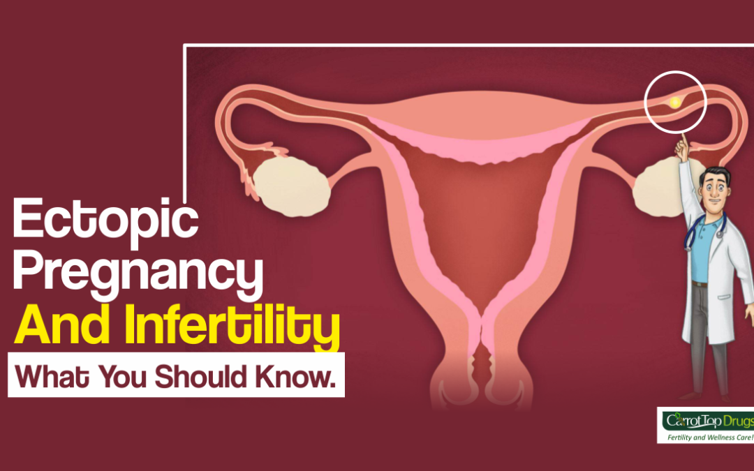 Ectopic Pregnancy And Infertility: What You Should Know.