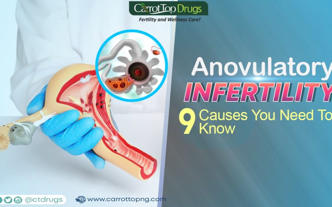 Anovulatory Infertility: 9 Causes You Need To Know.