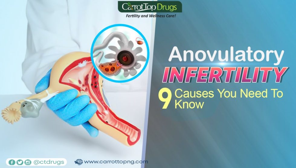 Anovulatory Infertility 9 Causes You Need To Know