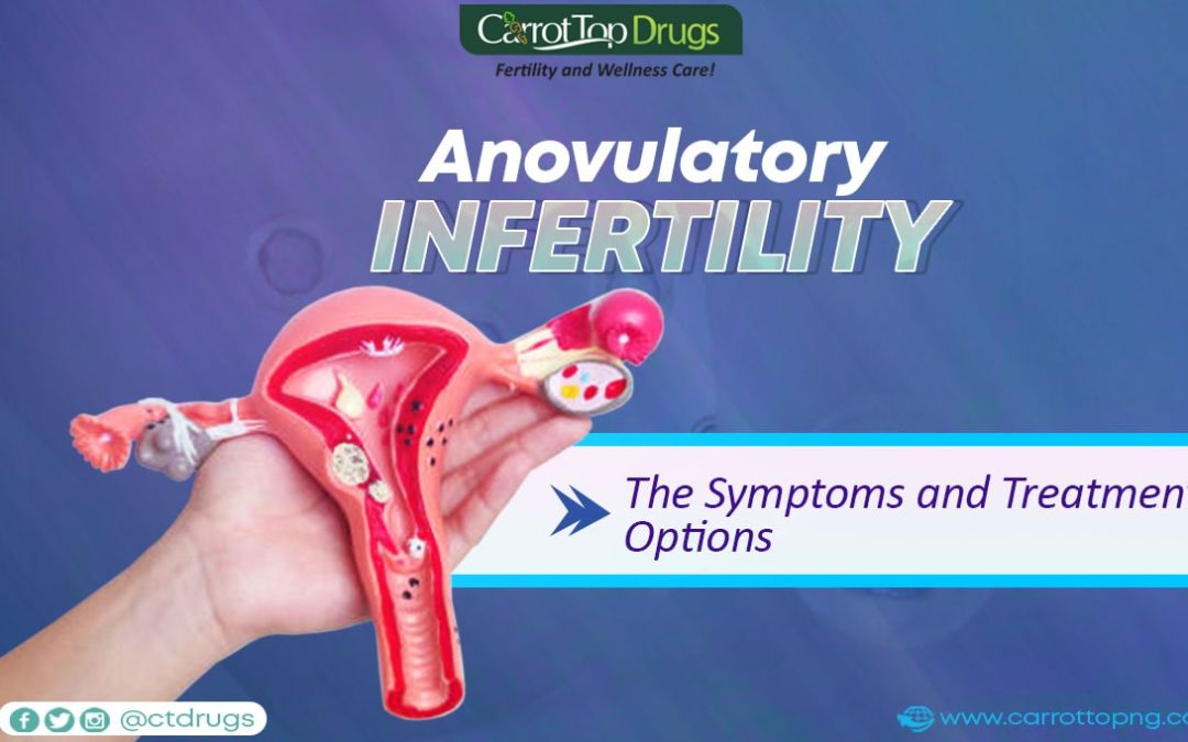 Anovulatory Infertility: The Symptoms and Treatments Options