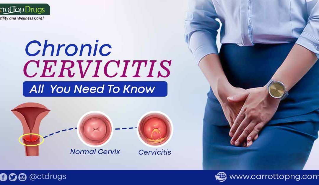 Chronic Cervicitis: All  You Need To Know.