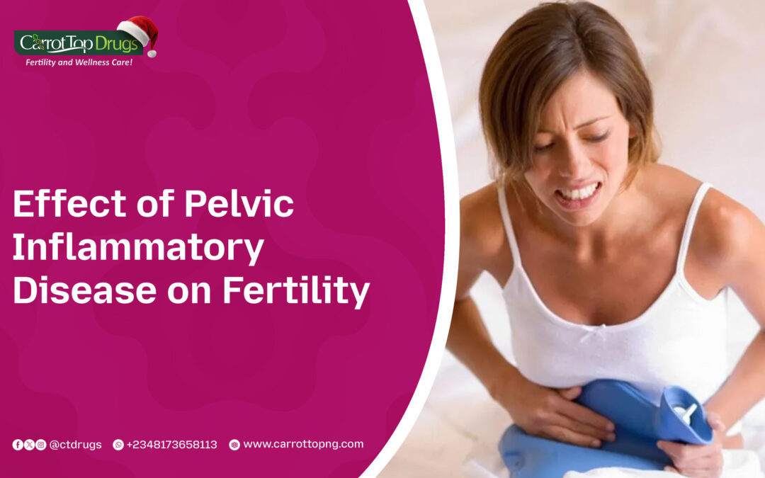 Effect of Pelvic Inflammatory Disease on Fertility
