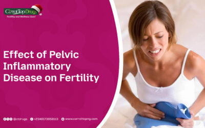 Effect of Pelvic Inflammatory Disease on Fertility