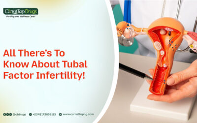 All There’s To Know About Tubal Factor Infertility!