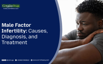Male Factor Infertility: Causes, Diagnosis, and Treatment