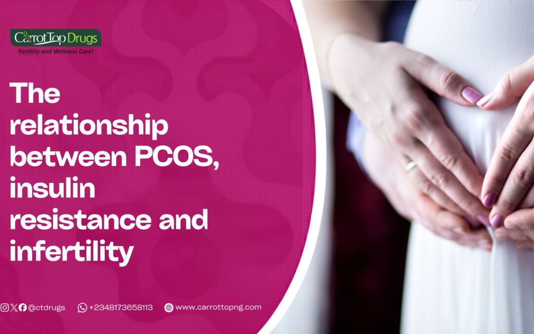 The Relationship Between PCOS, Insulin Resistance, and Infertility